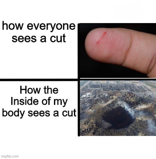 Blank Starter Pack Meme | how everyone sees a cut; How the Inside of my body sees a cut | image tagged in memes,blank starter pack | made w/ Imgflip meme maker