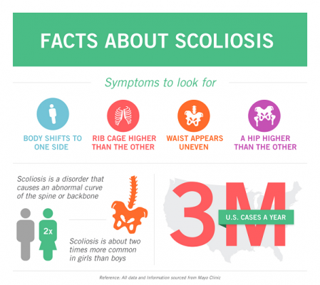 Facts About Idiopathic Scoliosis(IS) - Align Brace Blank Meme Template