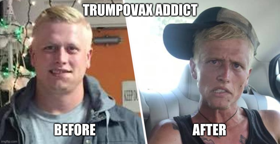 Meth addict - before after | TRUMPOVAX ADDICT; BEFORE                                      AFTER | image tagged in meth addict - before after | made w/ Imgflip meme maker