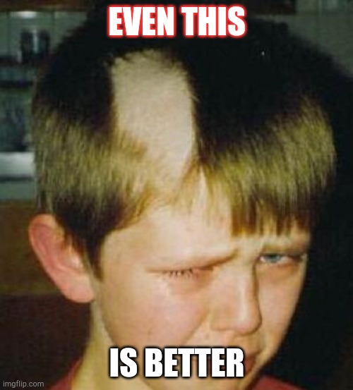 EVEN THIS IS BETTER | image tagged in bad haircut | made w/ Imgflip meme maker