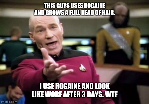 Picard Wtf | THIS GUYS USES ROGAINE AND GROWS A FULL HEAD OF HAIR. I USE ROGAINE AND LOOK LIKE WORF AFTER 3 DAYS. WTF | image tagged in memes,picard wtf | made w/ Imgflip meme maker