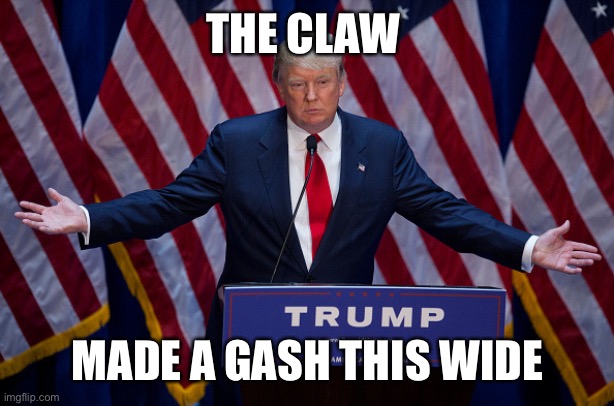 Donald Trump | THE CLAW; MADE A GASH THIS WIDE | image tagged in donald trump | made w/ Imgflip meme maker