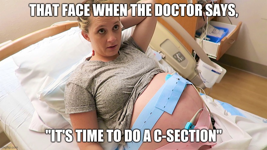 Sunroof delivery time! | THAT FACE WHEN THE DOCTOR SAYS, "IT'S TIME TO DO A C-SECTION" | image tagged in pregnant nst,doctor,c-section,shocked face | made w/ Imgflip meme maker