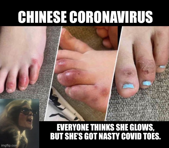 She’s Got Nasty COVID Toes | CHINESE CORONAVIRUS; EVERYONE THINKS SHE GLOWS,
BUT SHE’S GOT NASTY COVID TOES. | image tagged in nasty covid toes,kim carnes,covid-19,coronavirus,made in china,memes | made w/ Imgflip meme maker