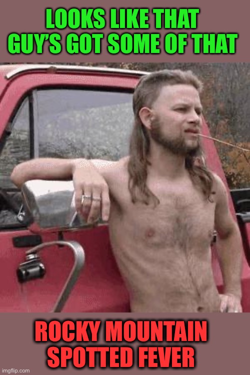 almost redneck | LOOKS LIKE THAT GUY’S GOT SOME OF THAT ROCKY MOUNTAIN SPOTTED FEVER | image tagged in almost redneck | made w/ Imgflip meme maker