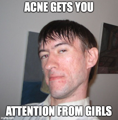 Acne | ACNE GETS YOU; ATTENTION FROM GIRLS | image tagged in acne,pimple,memes | made w/ Imgflip meme maker