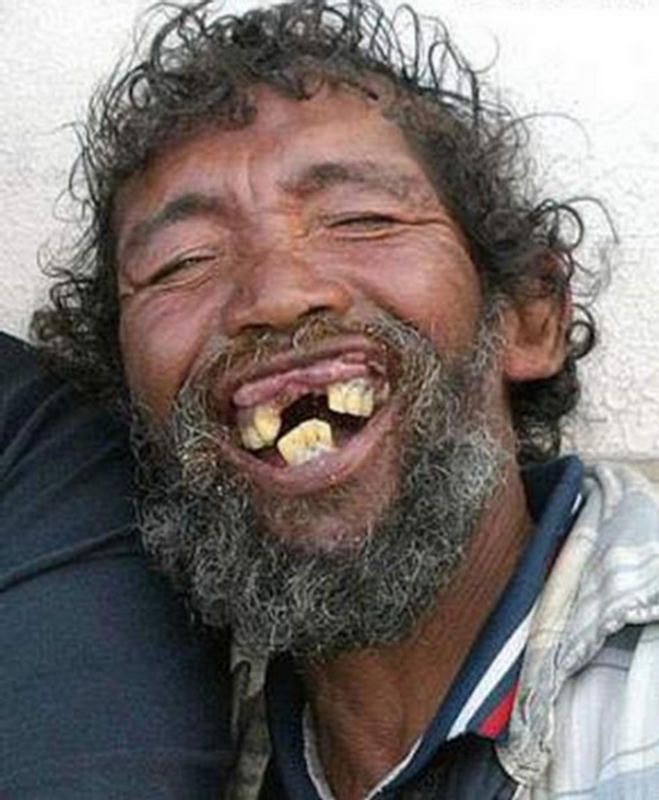 Guy with bad teeth Memes - Imgflip.