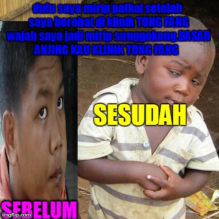 Third World Skeptical Kid Meme | dulu saya mirip patkai setelah saya berobat di klinik TONG FANG wajah saya jadi mirip sunggokong.DASAR ANJING KAU KLINIK TONG FANG   SEBELUM | image tagged in memes,third world skeptical kid | made w/ Imgflip meme maker