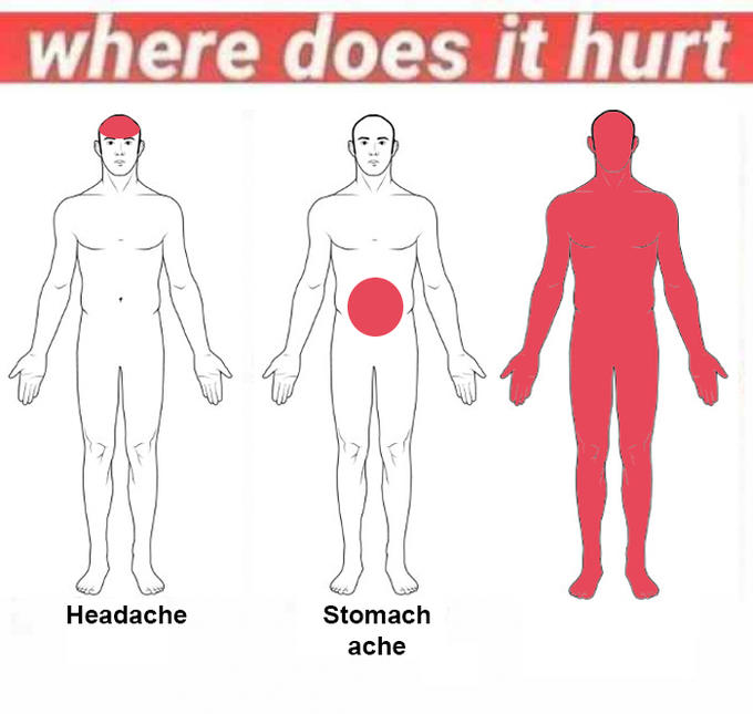 High Quality where does it hurt? Blank Meme Template