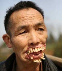 Chinese Teeth Meme Template