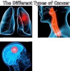 Types of Cancer Meme Template