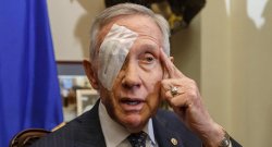 Harry Reid injury Meme Template