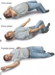 Seizure , dies Meme Template