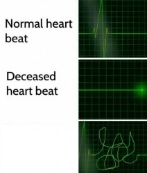 Heart Beat Meme Template