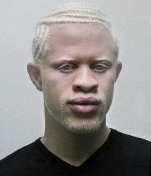 Albino Black guy Meme Template