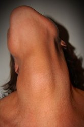 neck Meme Template