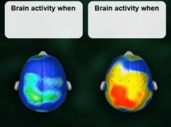 Brain activity when X, Brain activity when Y Meme Template