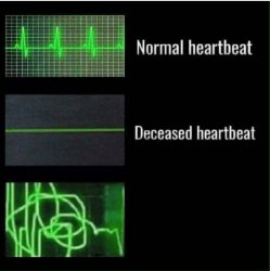 normal heartbeat deceased heartbeat Meme Template