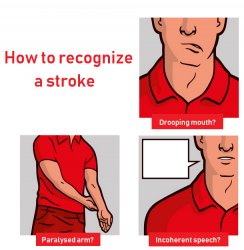 signs of a stroke Meme Template
