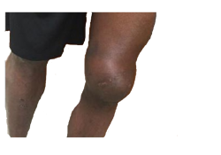 Knee Grow Meme Template