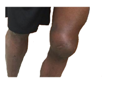 Knee Grow Meme Template