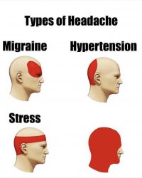 Types of headaches Meme Template