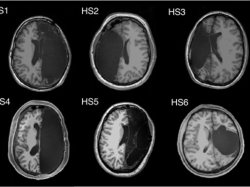 Liberal brain scans Meme Template