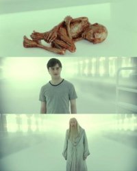 Dead Baby Voldemort / What Happened To Him Meme Template