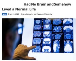 No Brain, Normal Life Meme Template
