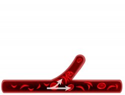 sickle cell Meme Template