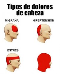 Tipos de dolores de cabeza Meme Template