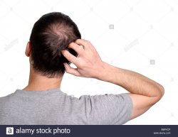 Man Scratching Back Of Head Meme Template
