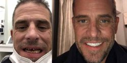 Hunter Biden meth mouth before and after Meme Template