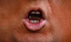 Trump Anus Meme Template