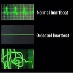 Messed up heartbeat Meme Template
