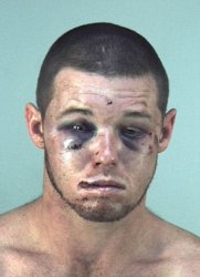 Mug shot Beaten up guy Meme Template
