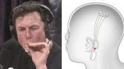 Elon Musk Brain Chip Meme Template