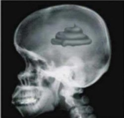 X-rays poop brain #1 Meme Template