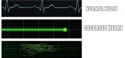 Heart rate Meme Template