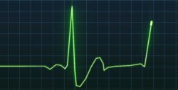 Heart rate Meme Template