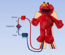 Tickle me ECMO Meme Template