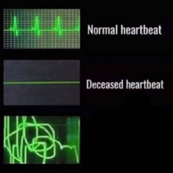 Heart attack Meme Template