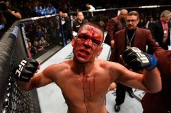 nate diaz Meme Template