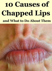 10 causes of chapped lips Meme Template