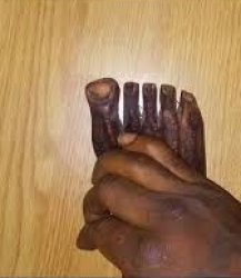 quandale dingles leaked foot pics Meme Template