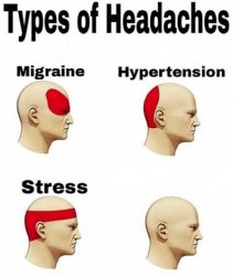 Types of headaches (cleared) Meme Template