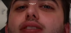 Chris in pain Meme Template