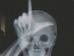 Take the L on a X-Ray Meme Template