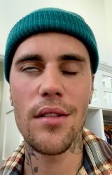 Justin Bieber Face Paralyzed Meme Template