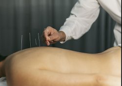 Acupuncture & Registered Massage Therapy Meme Template